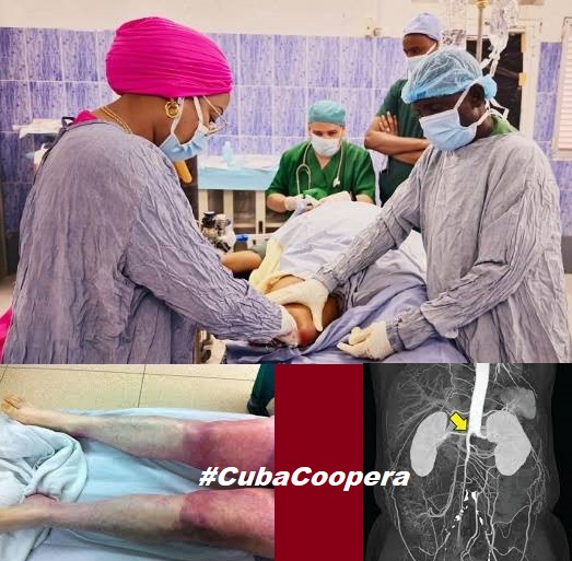 Síndrome de Leriche, enfermedad tratada por los cooperantes