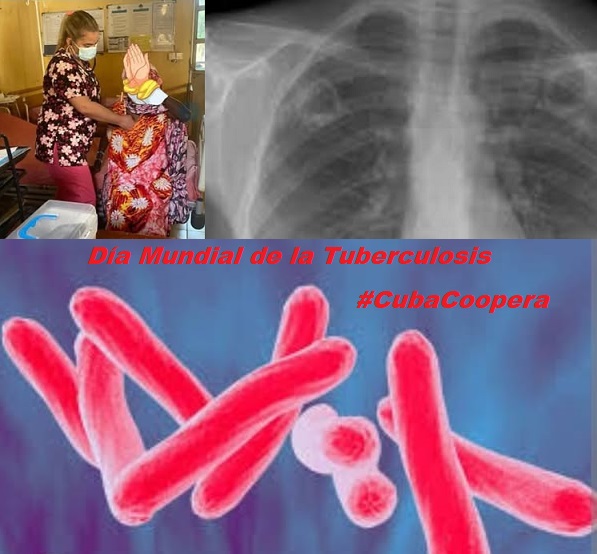 Día Mundial de la Tuberculosis