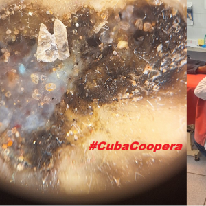 Dermastocopia en paciente africano